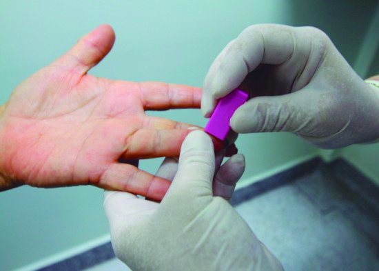Jacareí realiza testes de hepatite viral; 21 casos foram registrados este ano