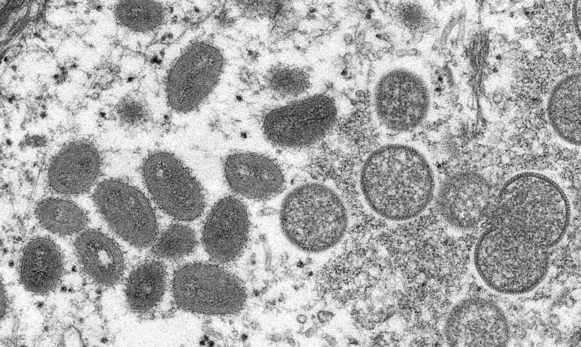 Ministério da Saúde cria sala de situação para monitorar varíola dos macacos no país