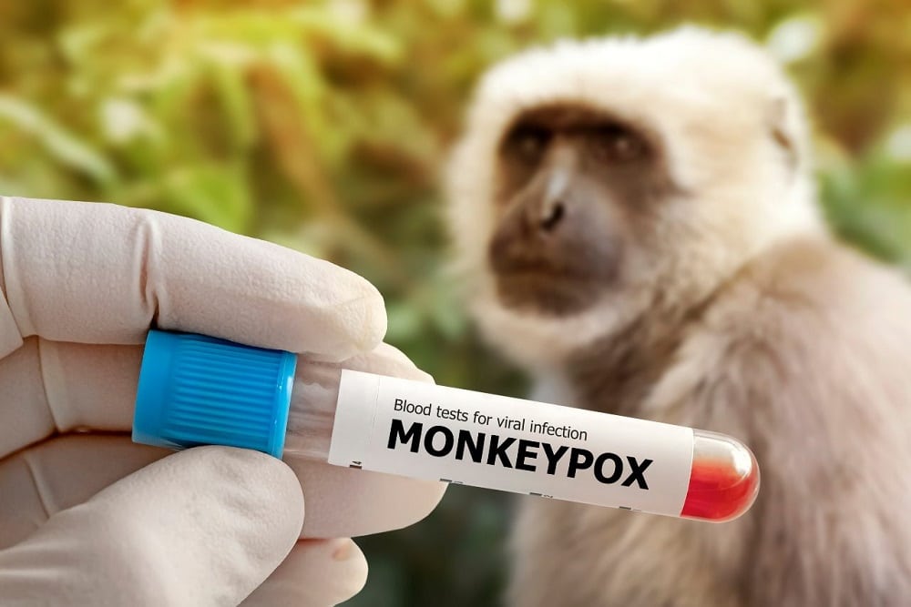 São notificados mais de 500 casos da varíola do macaco no Estado de São Paulo