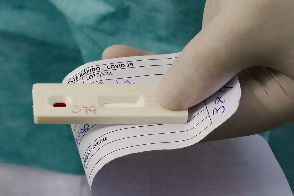 Testes em livre demanda da Covid-19, em Mogi, contarão com distribuição de senhas