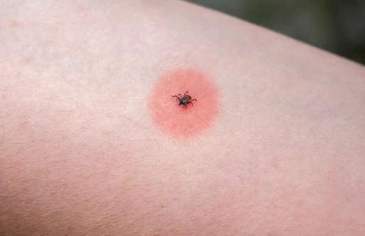 Infestação de carrapatos preocupa moradores em Guararema