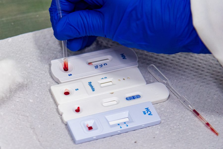 Prefeitura de Guararema oferece testes rápidos e gratuitos para ISTs a partir de segunda-feira (24)